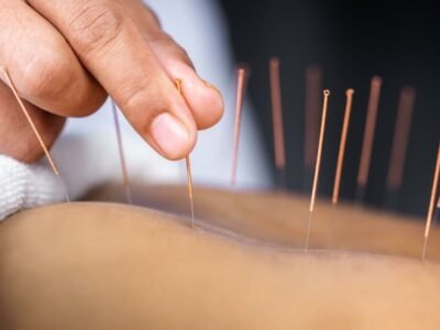 Introduction à l’Acupuncture : L’art de l’équilibre par le Qi